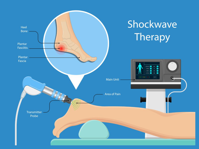 sóng xung kích shockwave