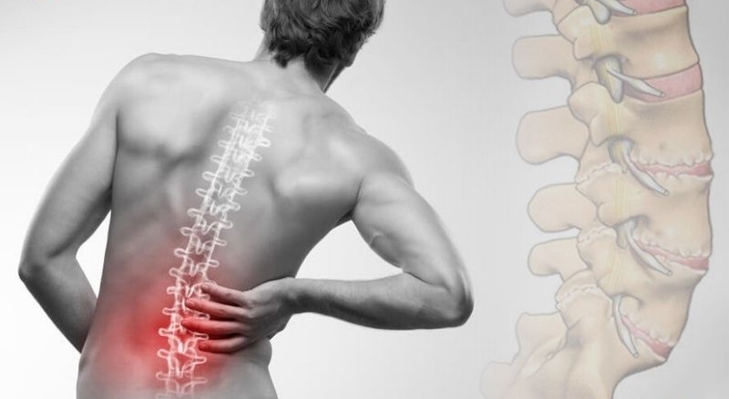 triệu chứng thoái hóa cột sống thắt lưng